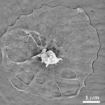 Mikroskopaufnahme eines Blutplättchens